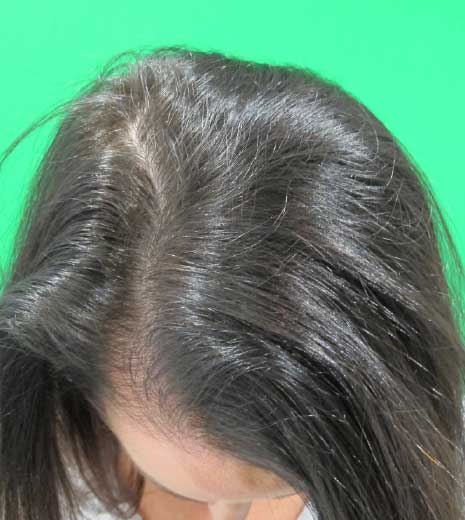 Hair growth results with vitamins 