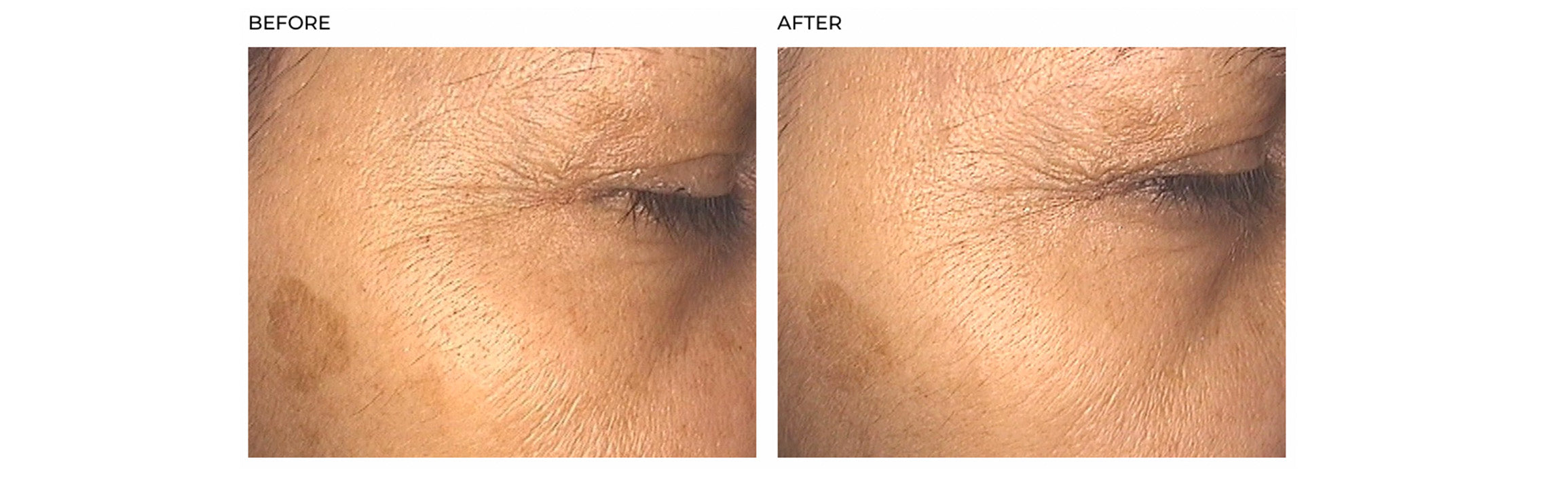 Hush & Hush SkinCapsule Brighten+ results before & after 2