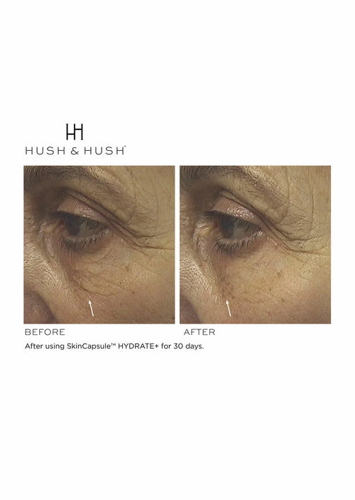 SkinCapsule HYDRATE+ - Hush & Hush