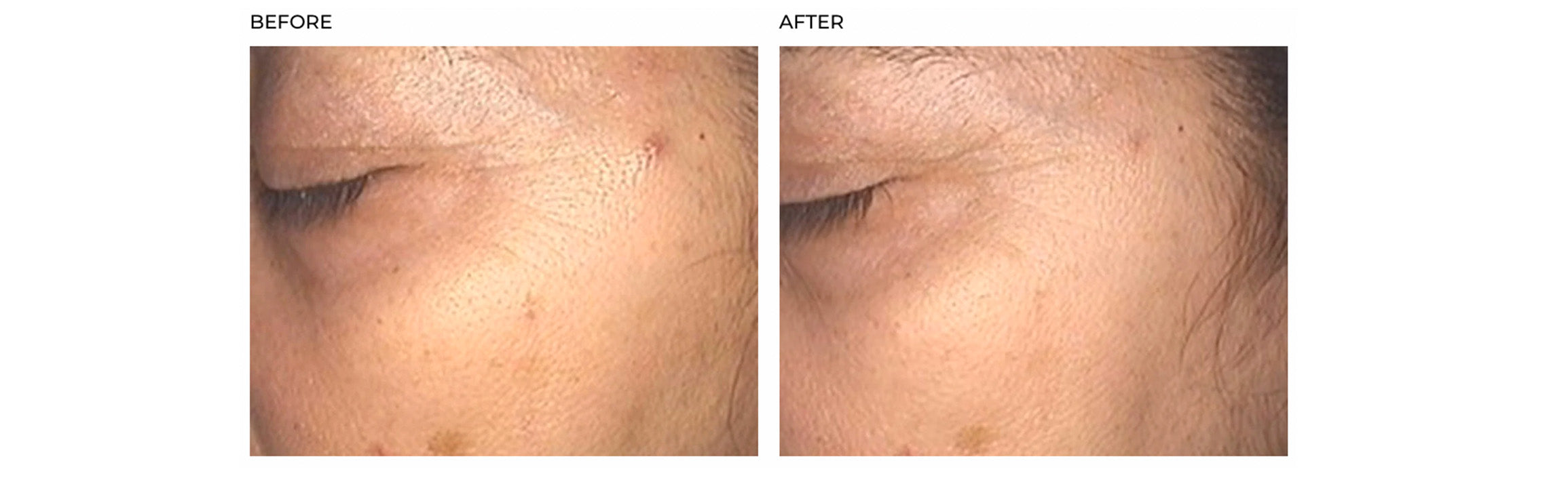 Hush & Hush SkinCapsule Brighten+ results before & after 3