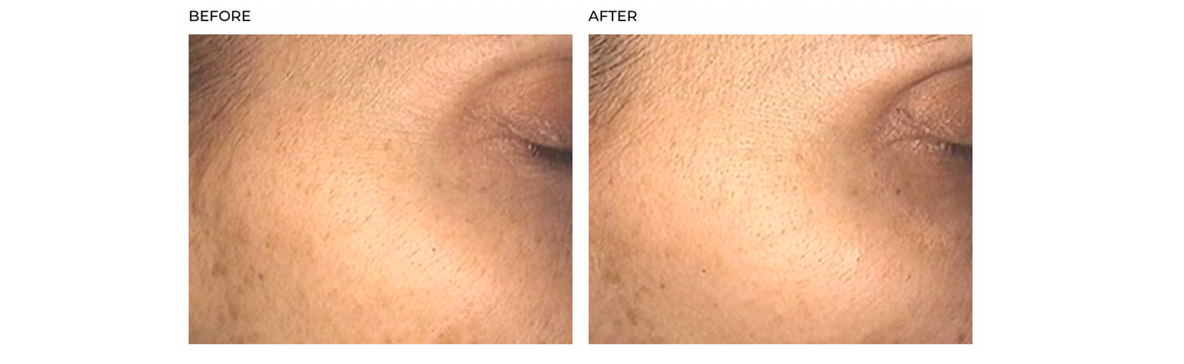Hush & Hush SkinCapsule Brighten+ results before & after